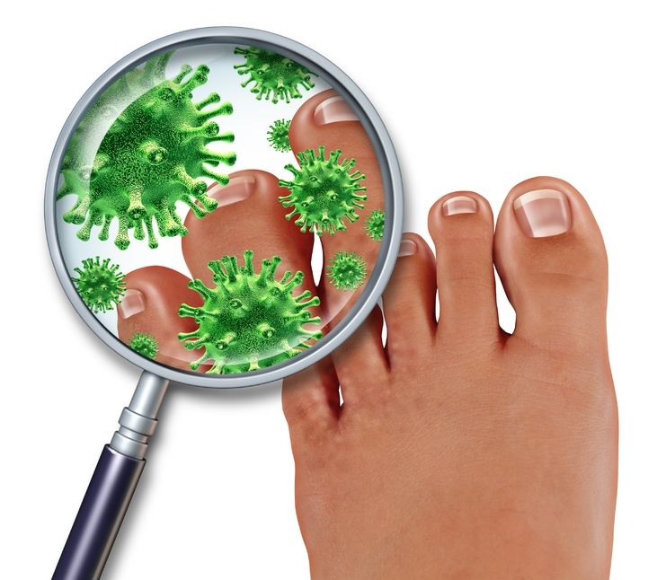 foot fungal infection