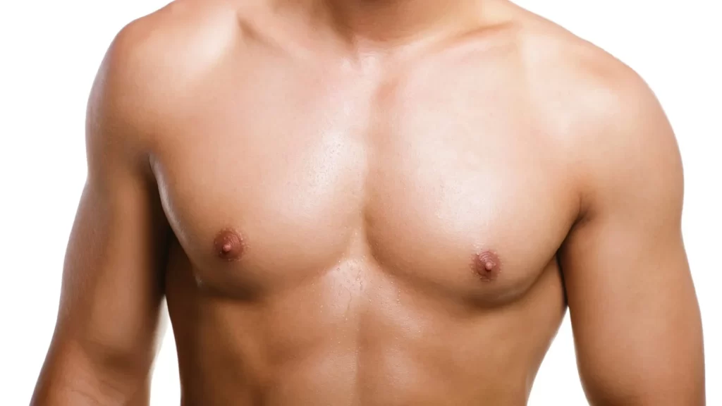 Gynecomastia 
